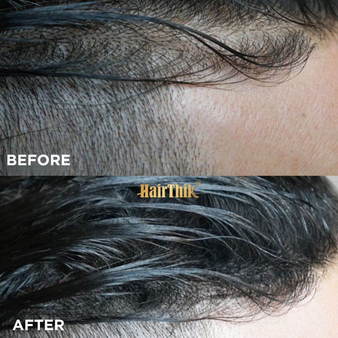 Supreme Trimmer HairThik Hair Fibers - 55 Grams