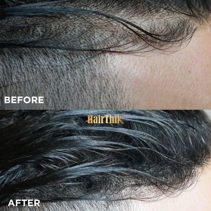 Supreme Trimmer HairThik Hair Fibers Kits